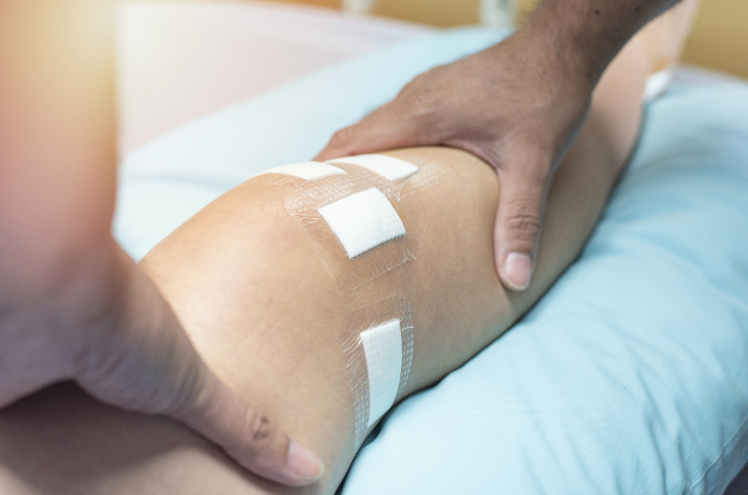 Advanced arthroscopic revision ACL reconstruction surgery